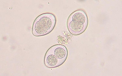 Coccidia under a microscope