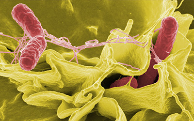 Salmonella bacteria under a microscope